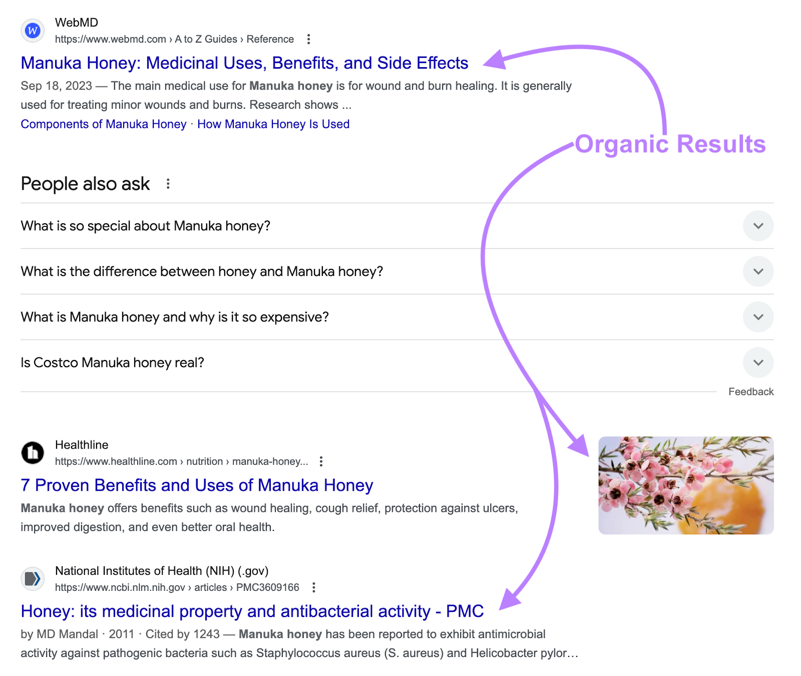 该top organic results for the keyword are high authority domains like WebMD, Healthline, and NIH.